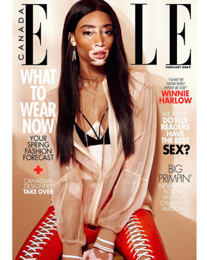 Inside the April issue of Remix with Winnie Harlow